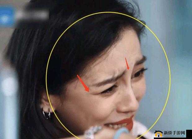 塞满嘴巴把脸撑大了能恢复吗:嘴巴被撑大后的恢复问题
