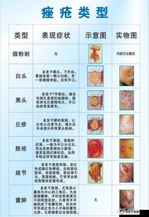 SP 发刷致红肿双丘:问题引发关注