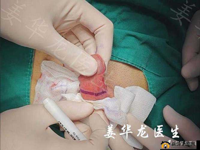 男生剥完皮到底什么样:深度揭秘
