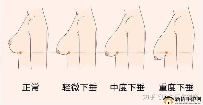 20 岁胸又软又下垂:探寻背后的秘密与改善方法