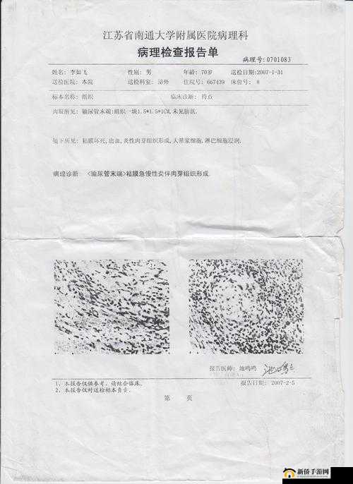 医生边做 B 超边仔细为我检查诊断