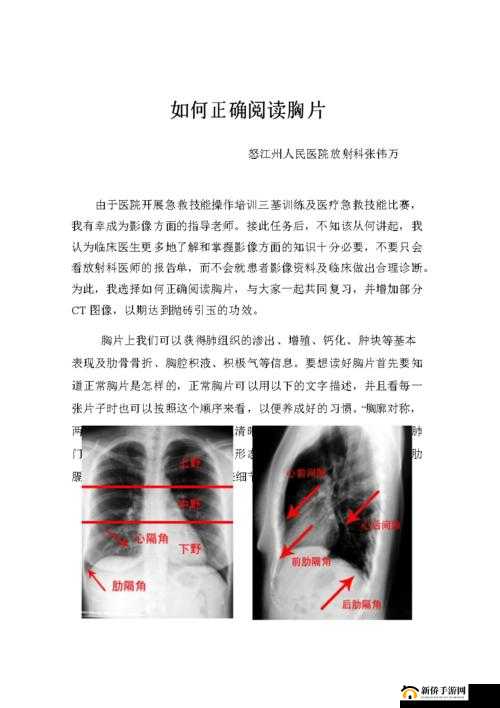 胸片全体曝光以及相关技术与应用的详细解读