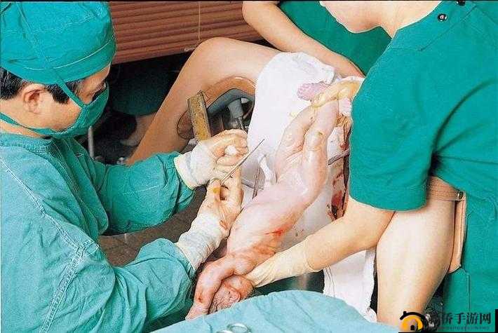 大肚美人生产双胞:生命的奇迹与爱