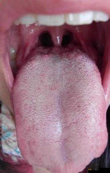当舌头舔到硬物时感到疼痛，这是怎么回事？
