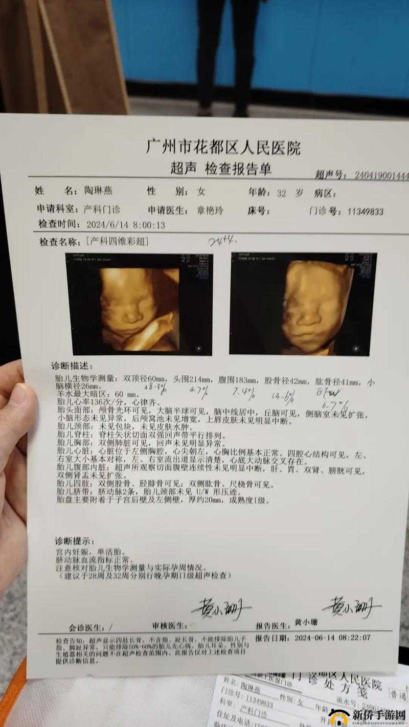 做彩超时医生总问做四维没有,这是为什么?