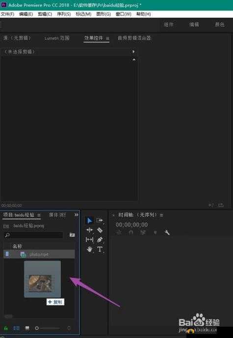 100%胸片曝光率软件 tiKtak:精准把控影像质量提升利器