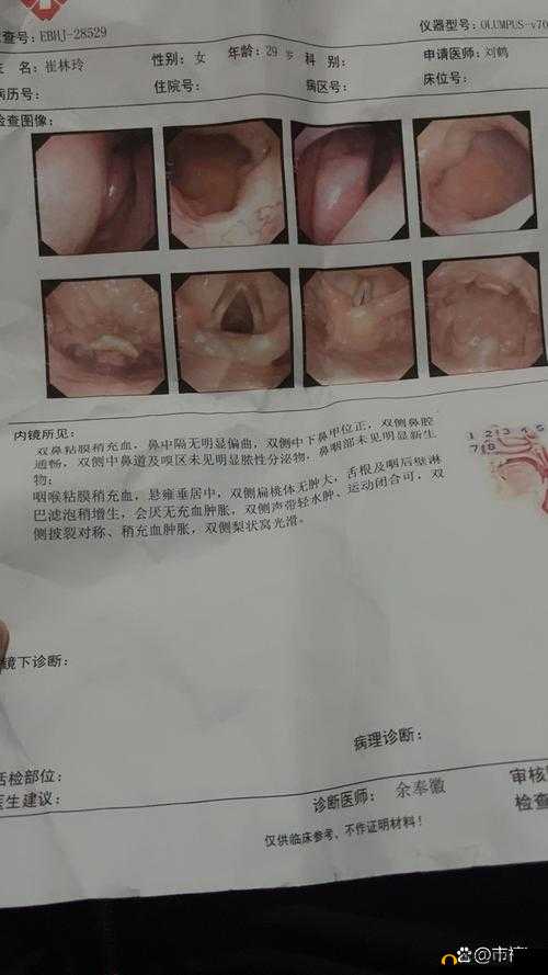 每次跟男朋友口完嗓子都发炎:探寻这一奇特现象背后的原因