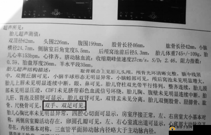 为什么做四维彩超前医生会问有没有做过 B 超？